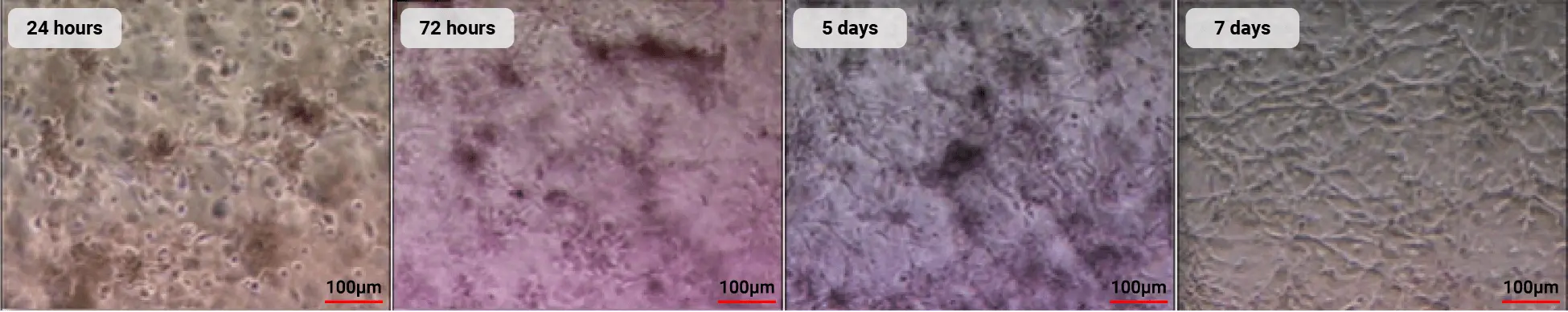 Illustration depicting the angiogenic property of stem cells, aiding in the repair and regeneration of blood vessels, thereby restoring the function of the blood circulation system.